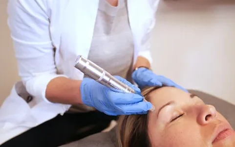 Microneedling & Facial Rejuvenation